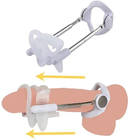 Quellix Traction Solution for Support and Enhancement