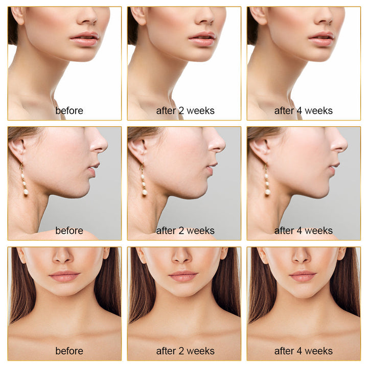 EMS Facial Slimmer with LED Therapy - Face Slimming and Double Chin Removal