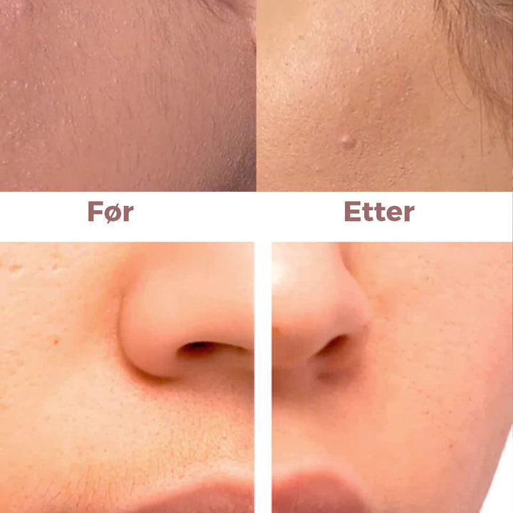 Facial Epilator - Instant, Painless Hair Removal