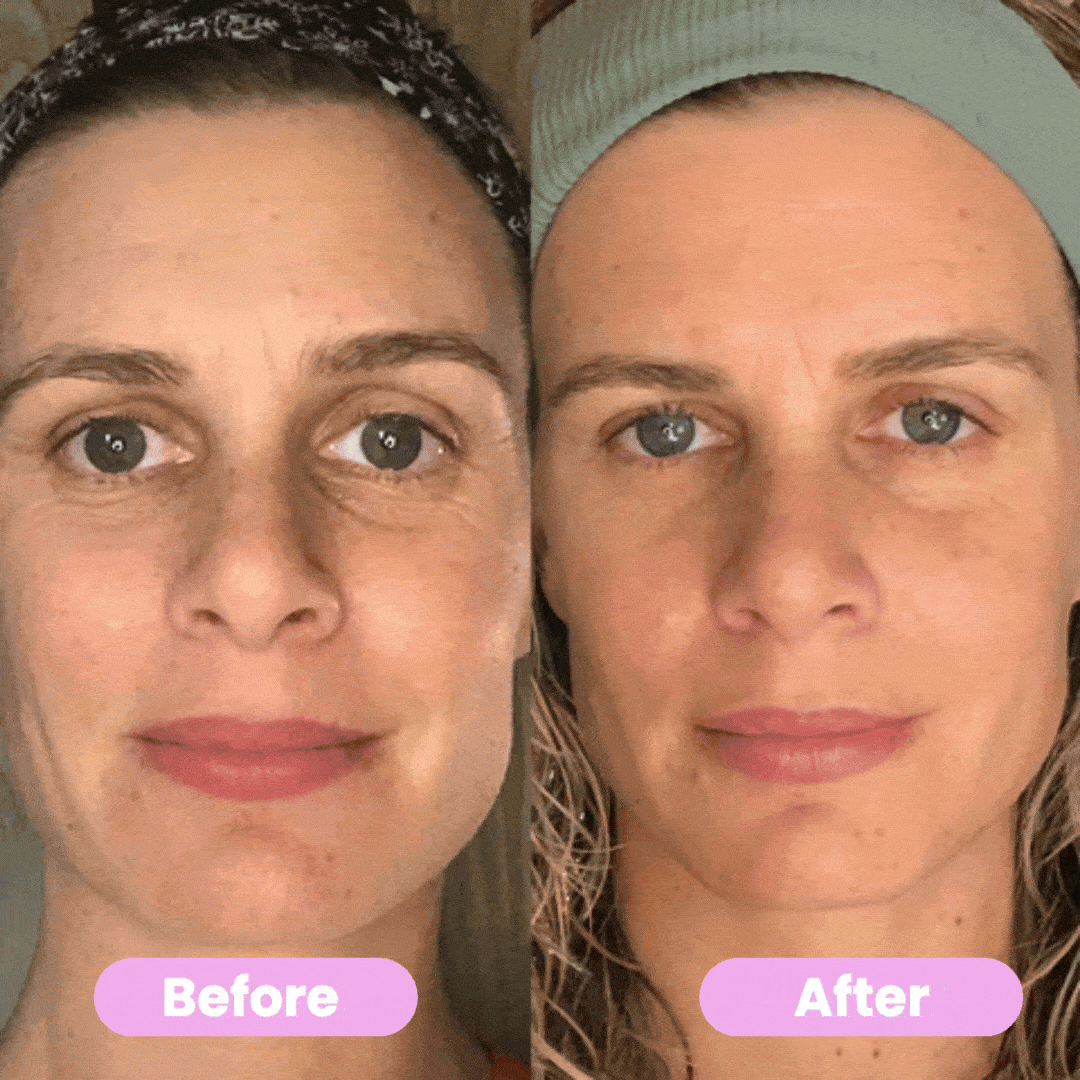 7-in-1 LED Facial Lifting and Massage Tool – Vénera