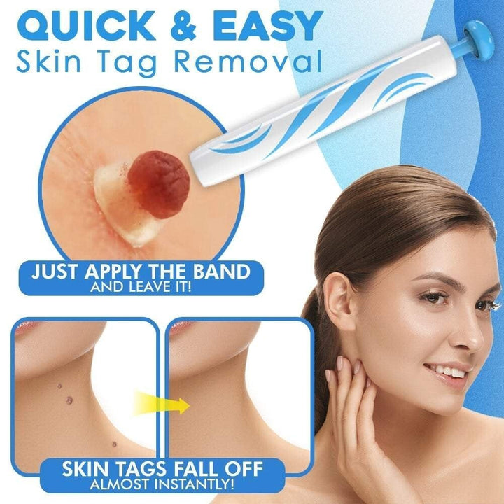 TagGone Automatic Skin Tag Removal Kit | Painless Application | For Smooth, Even Skin
