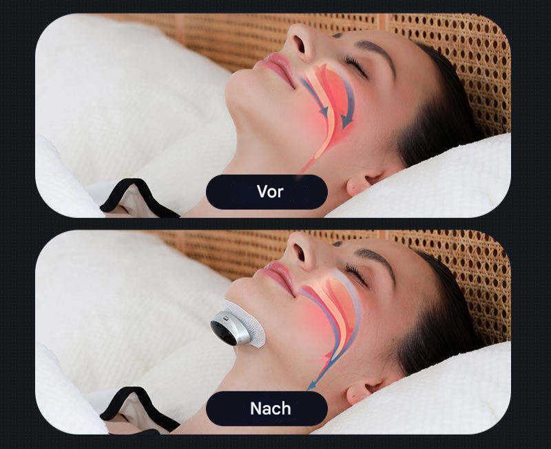 Sleep Apnoea Device - AirEase