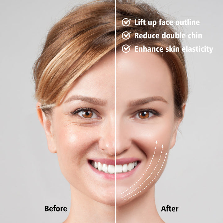 EMS Facial Slimmer with LED Therapy - Face Slimming and Double Chin Removal