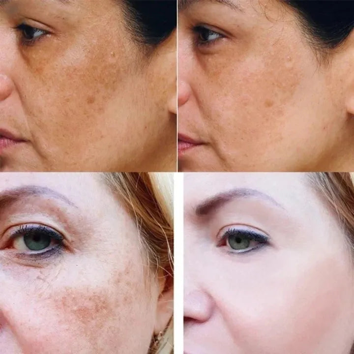 Turmeric Dark Spot Brightening Serum
